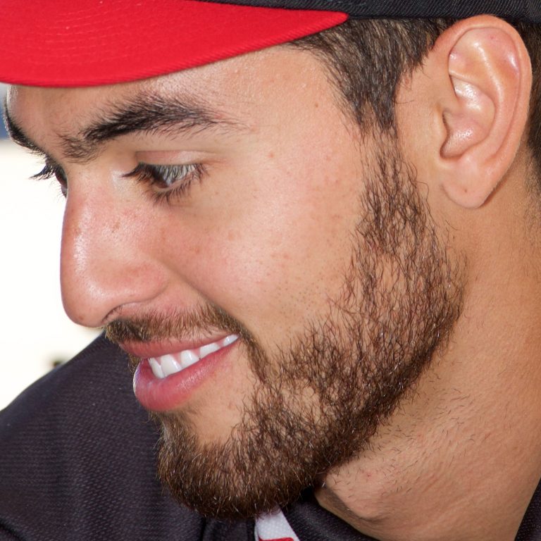 Bloss Injured; Bogle To Ride For Team Rocky Mountain ATV/MC-KTM-WPS (Supercross News)